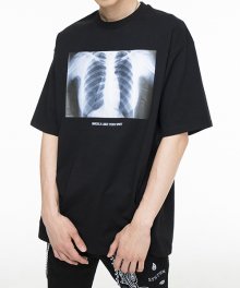 X-ray T-shirt