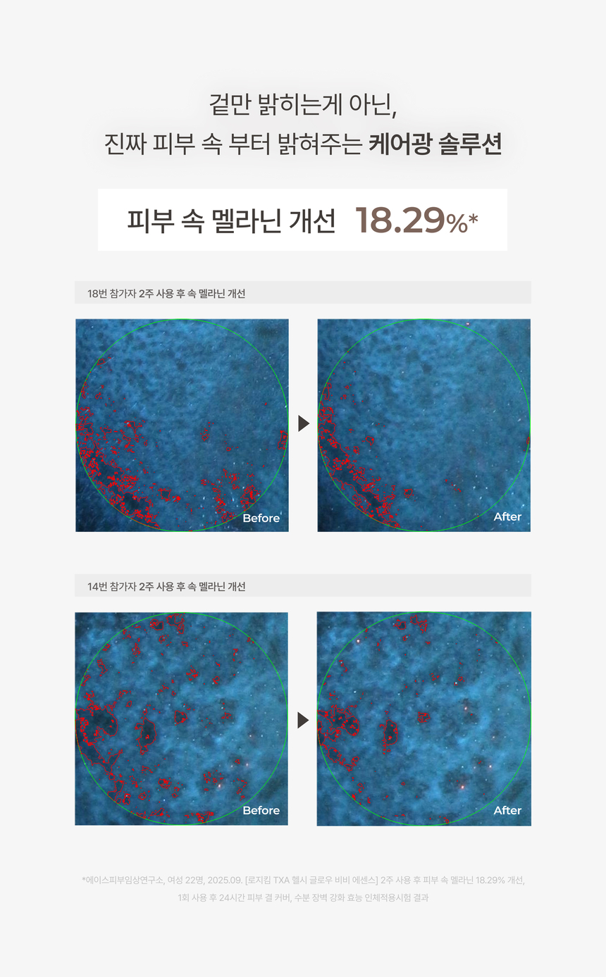 로지킴 비비에센스 21