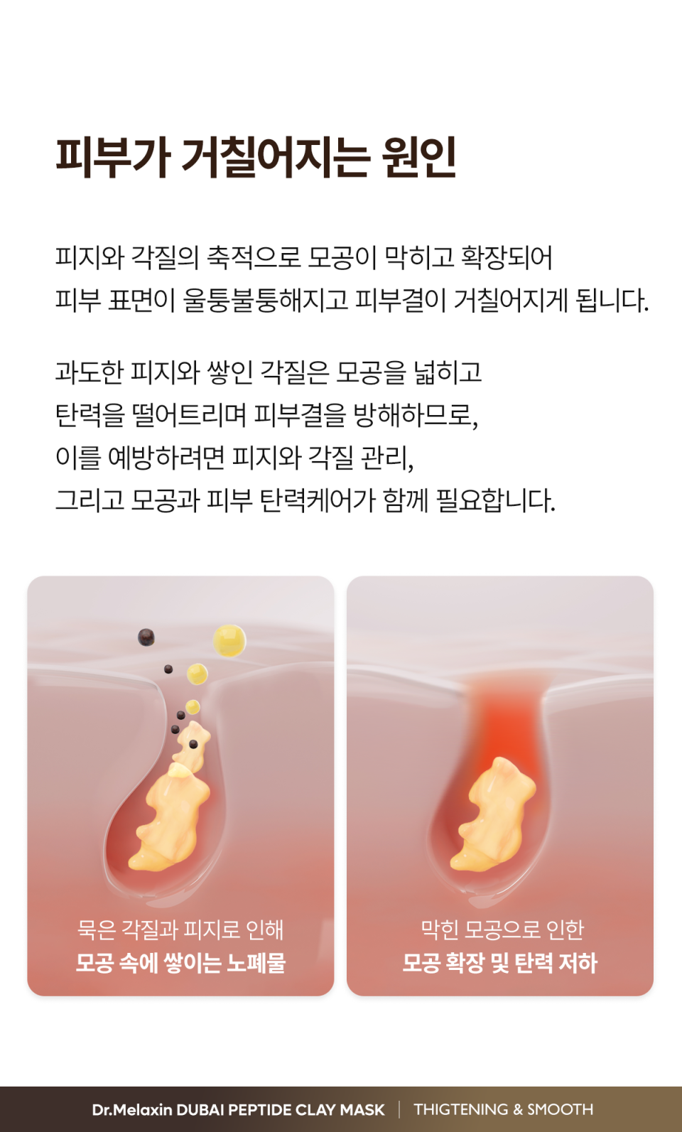 content-img-03