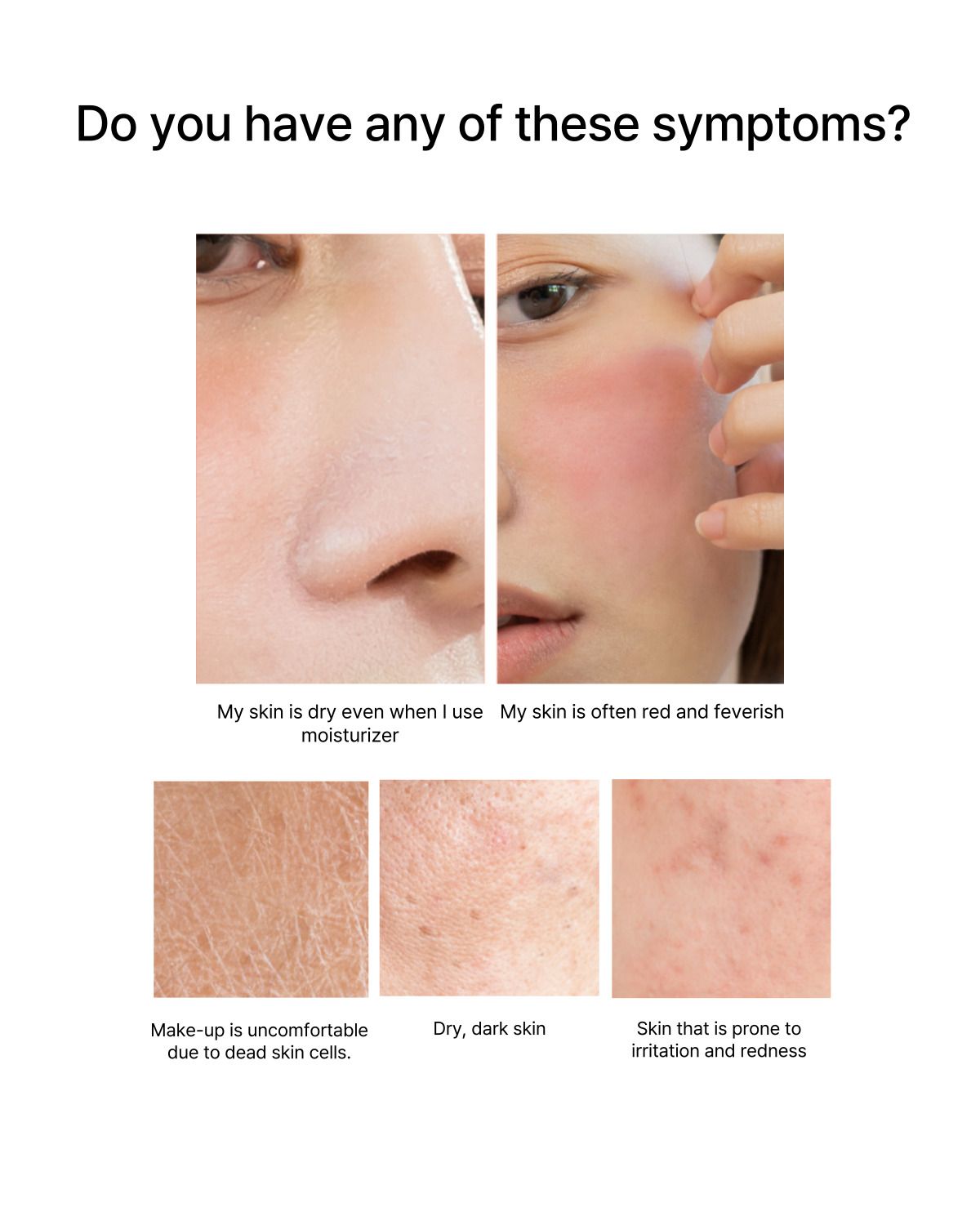 MUSINSA公式 | ONONE ブルーミングサボテンファーストトナー