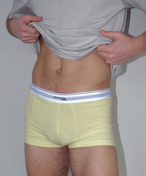 01 M.C Drawers / Lemon