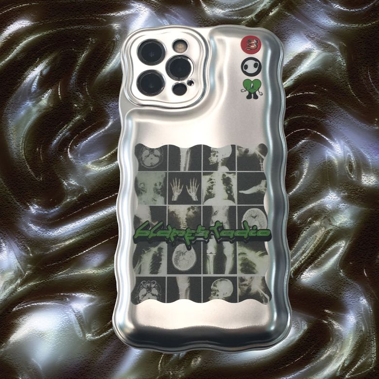 Metallic X-ray case
