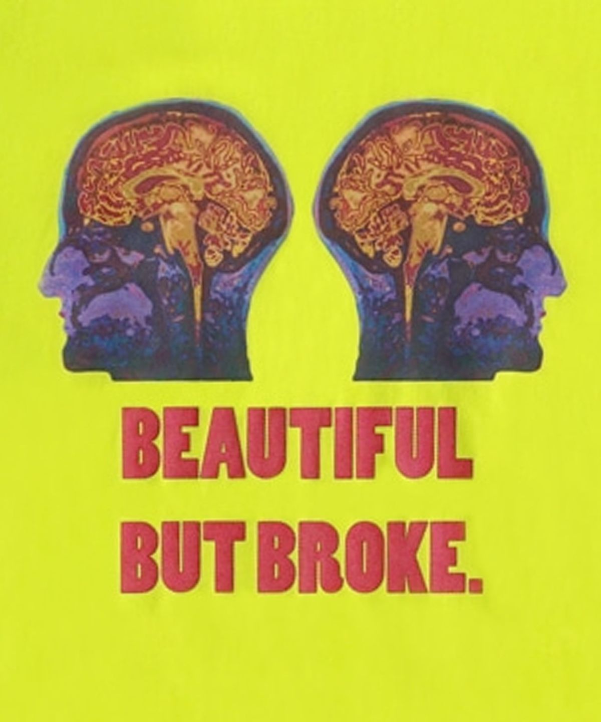 아임낫어휴먼비잉(I AM NOT A HUMAN BEING) Double Brain Short Sleeve T-Shirt - NEON