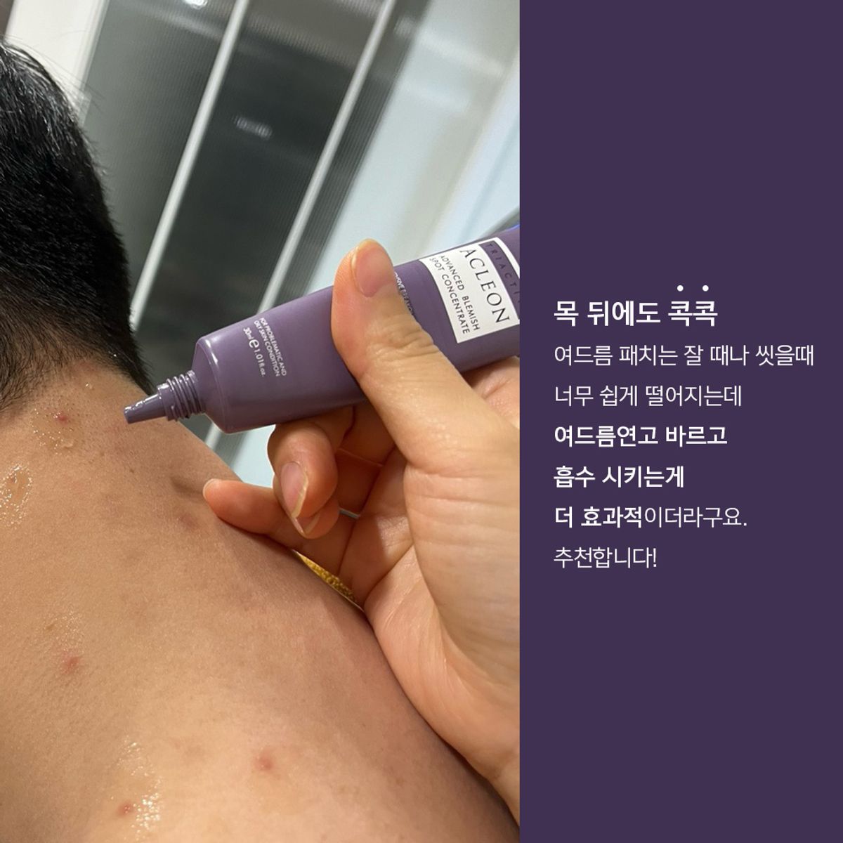 아클레온(ACLEON) 아나시스 아클레온 여드름  트러블 스팟 30ml