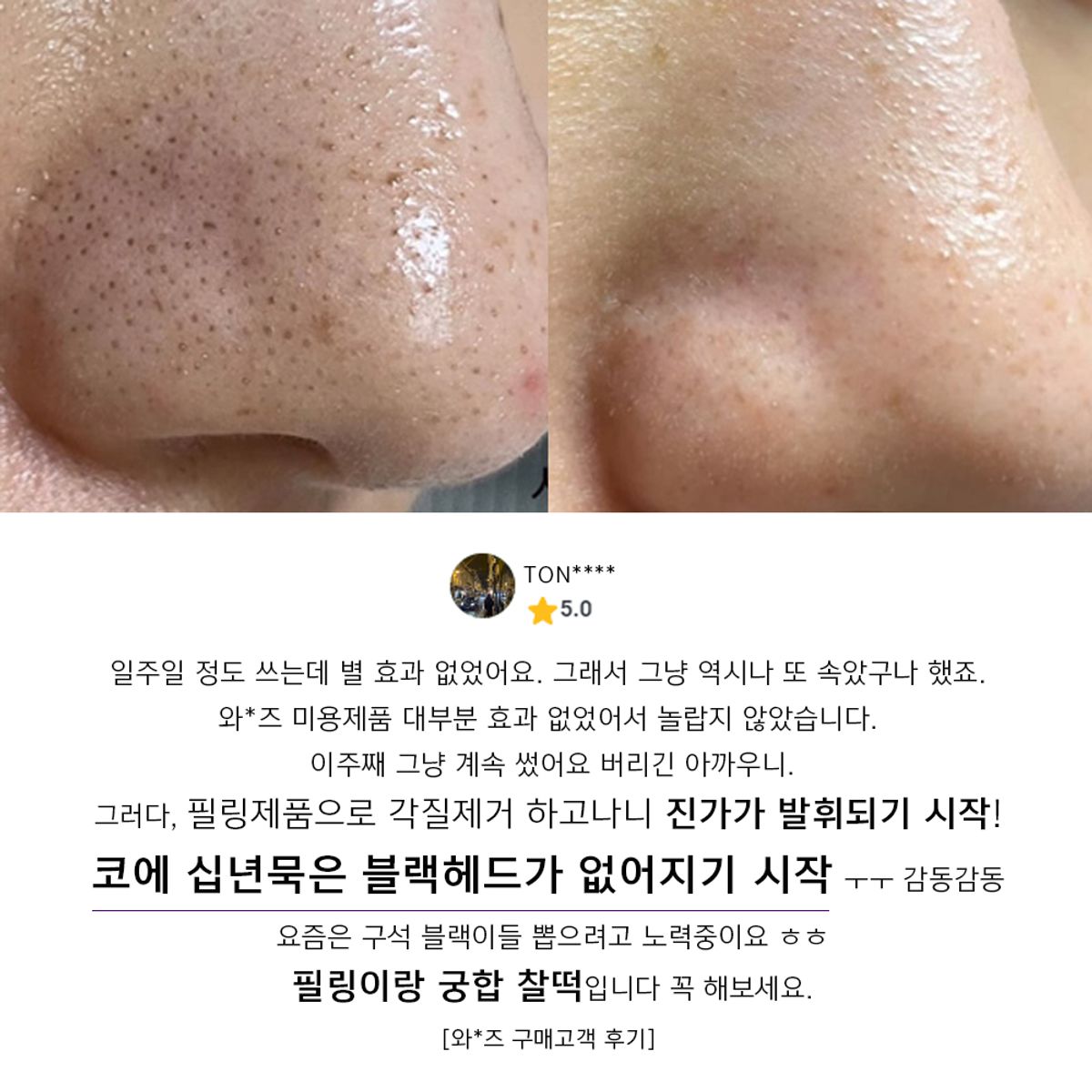 아클레온(ACLEON) 블랙헤드 피지연화제 지성피부 세안제 2종 세트
