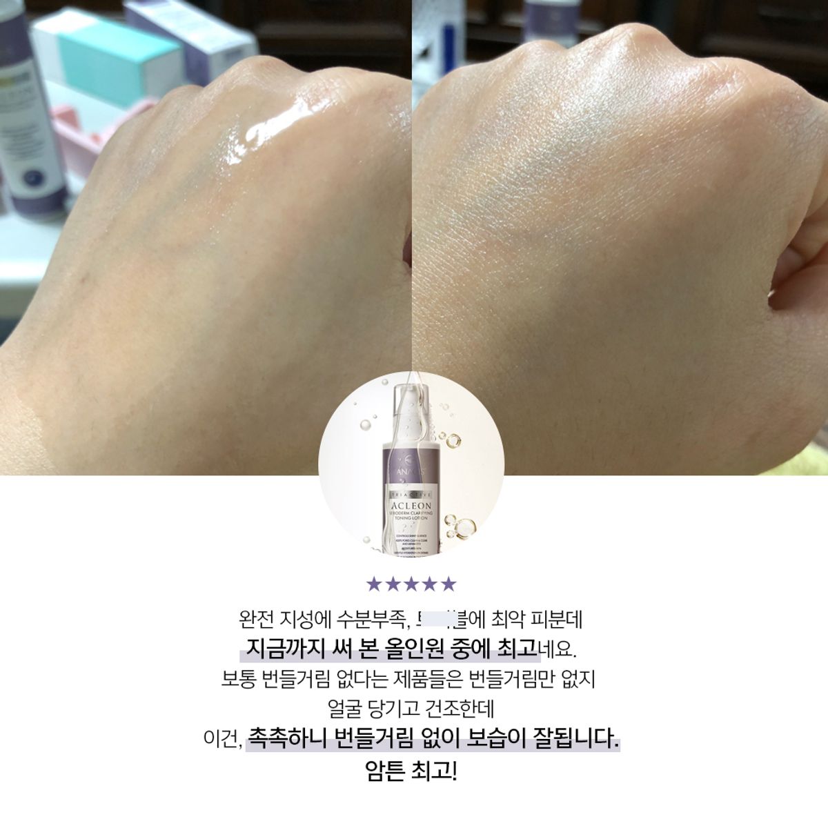 아클레온(ACLEON) 아나시스 청소년 여드름 화장품 약알칼리성클렌징폼 모공앰플 올인원 스킨로션 3종