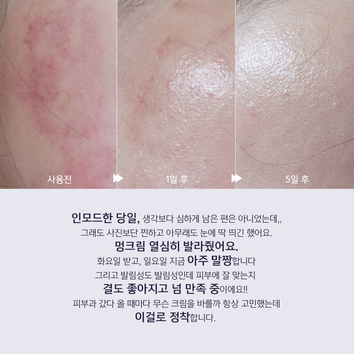 리더미스(LITHEMIS) 케이옥시덤 비타민K옥사이드 멍크림 15ml