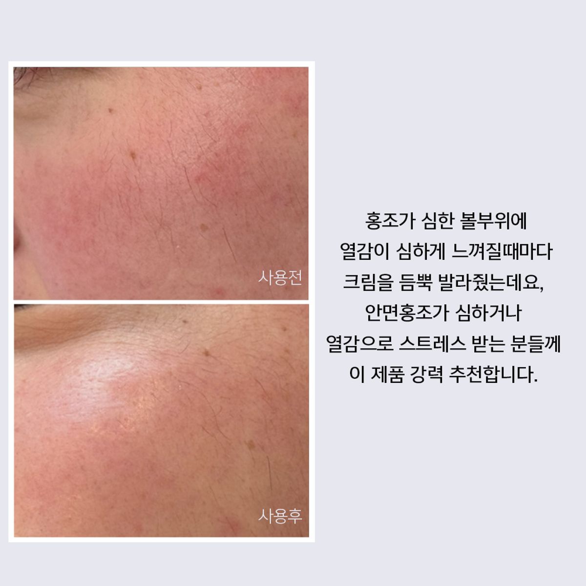 리더미스(LITHEMIS) 케이옥시덤 비타민K옥사이드 멍크림 15ml