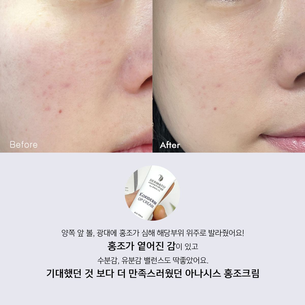 리더미스(LITHEMIS) 케이옥시덤 비타민K옥사이드 멍크림 15ml