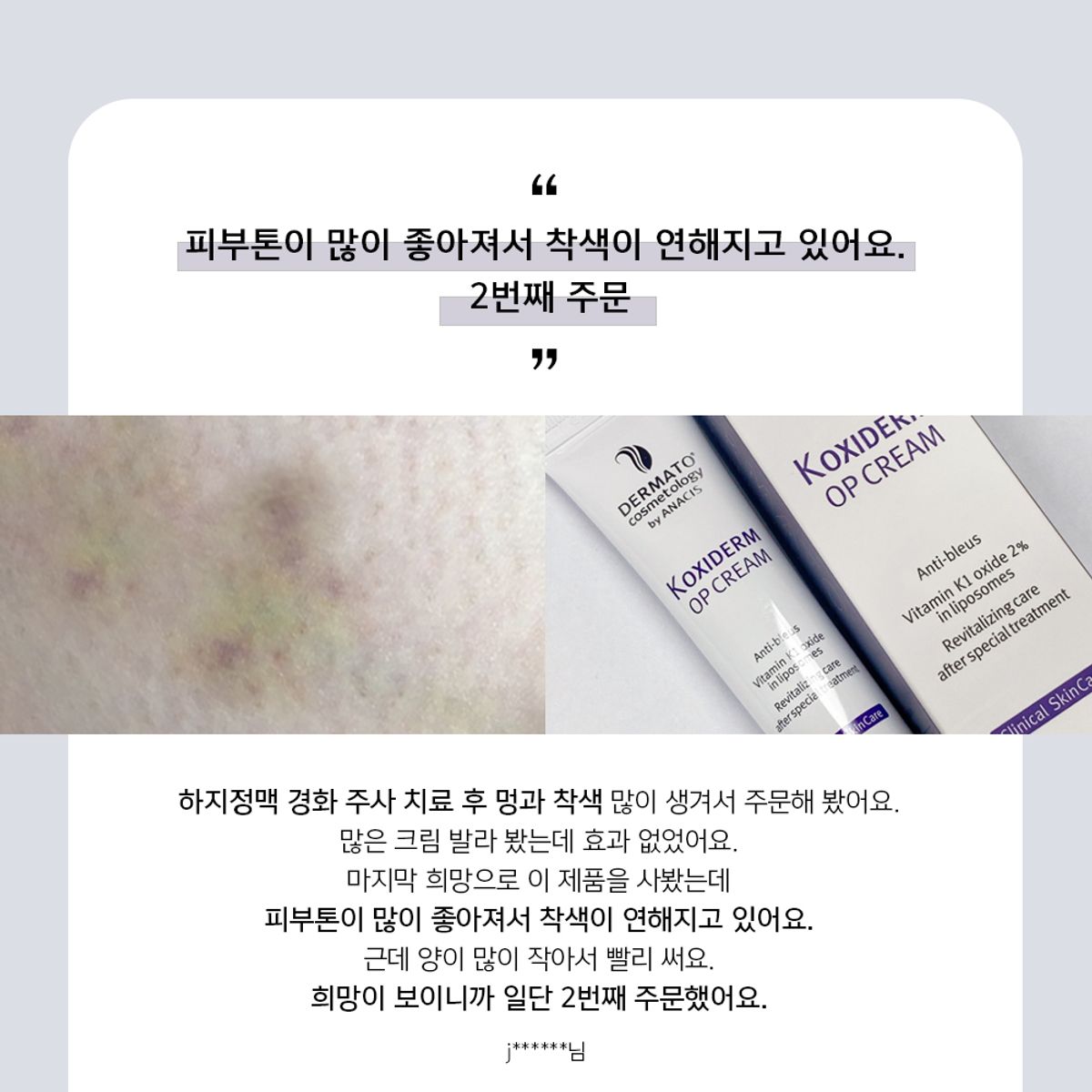 리더미스(LITHEMIS) 케이옥시덤 비타민K옥사이드 멍크림 15ml