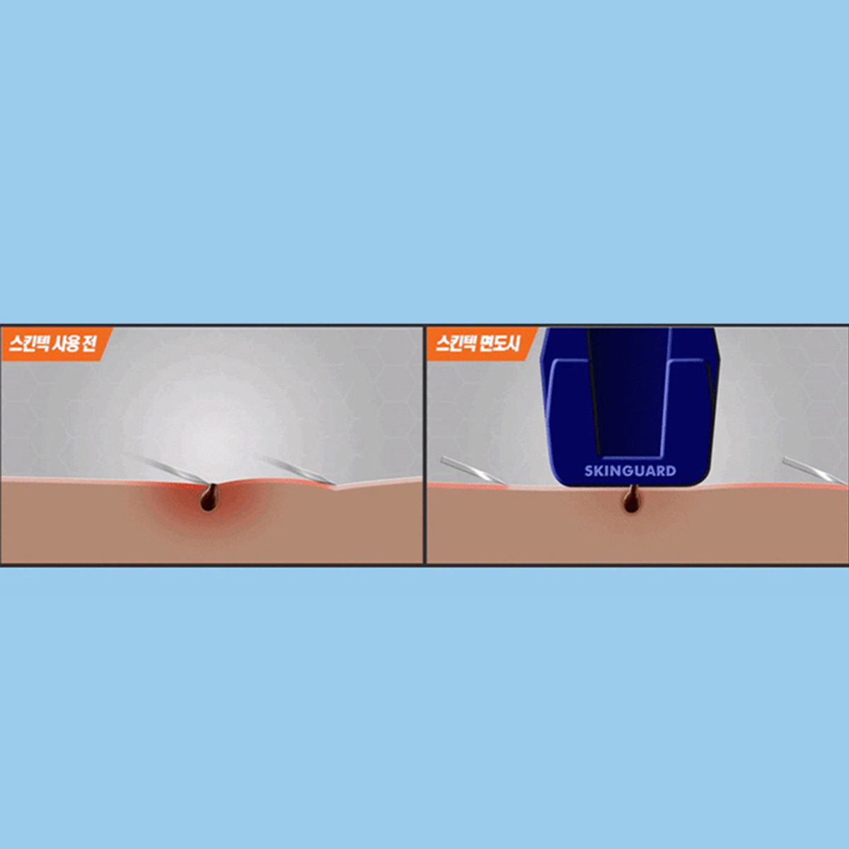 질레트(GILLETTE) 스킨텍 파워 면도기 핸들1 + 면도날 4입 + 미니젤 증정
