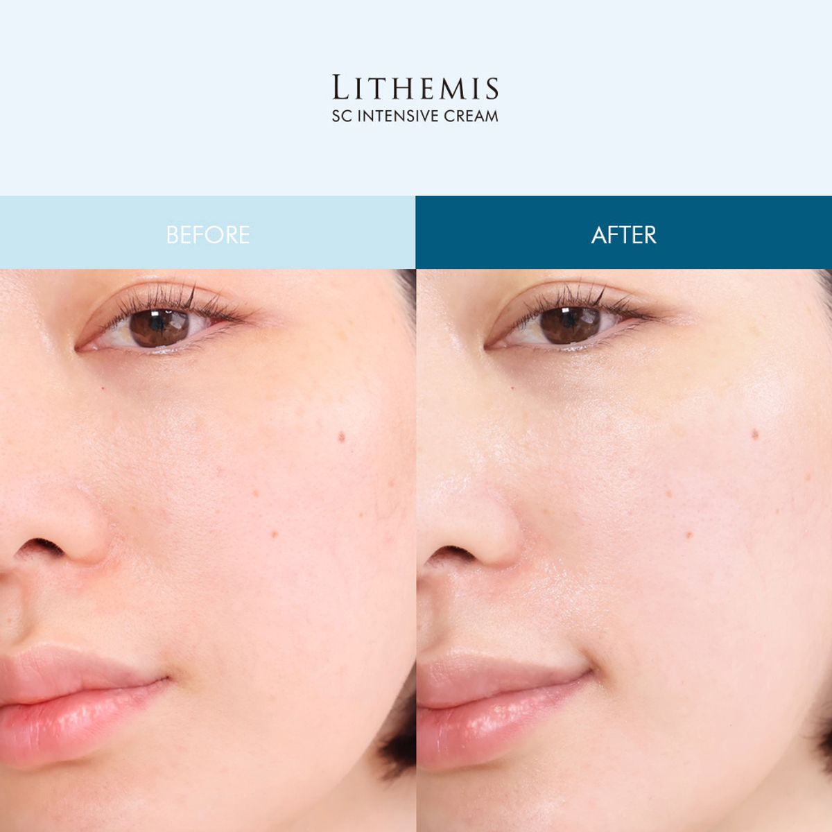 리더미스(LITHEMIS) 아나시스 판테놀 시카 세라마이드 재생크림 50ml