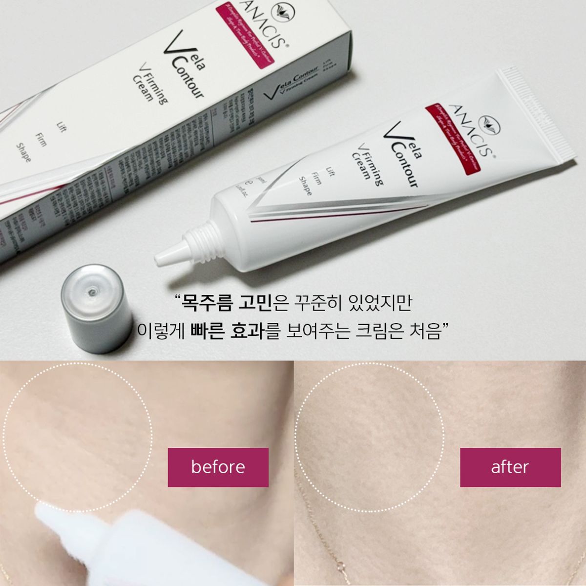 벨라컨투어(VELACONTOUR) 아나시스 주름개선 얼굴 목주름 팔자주름 리프팅 퍼밍 크림 30ml