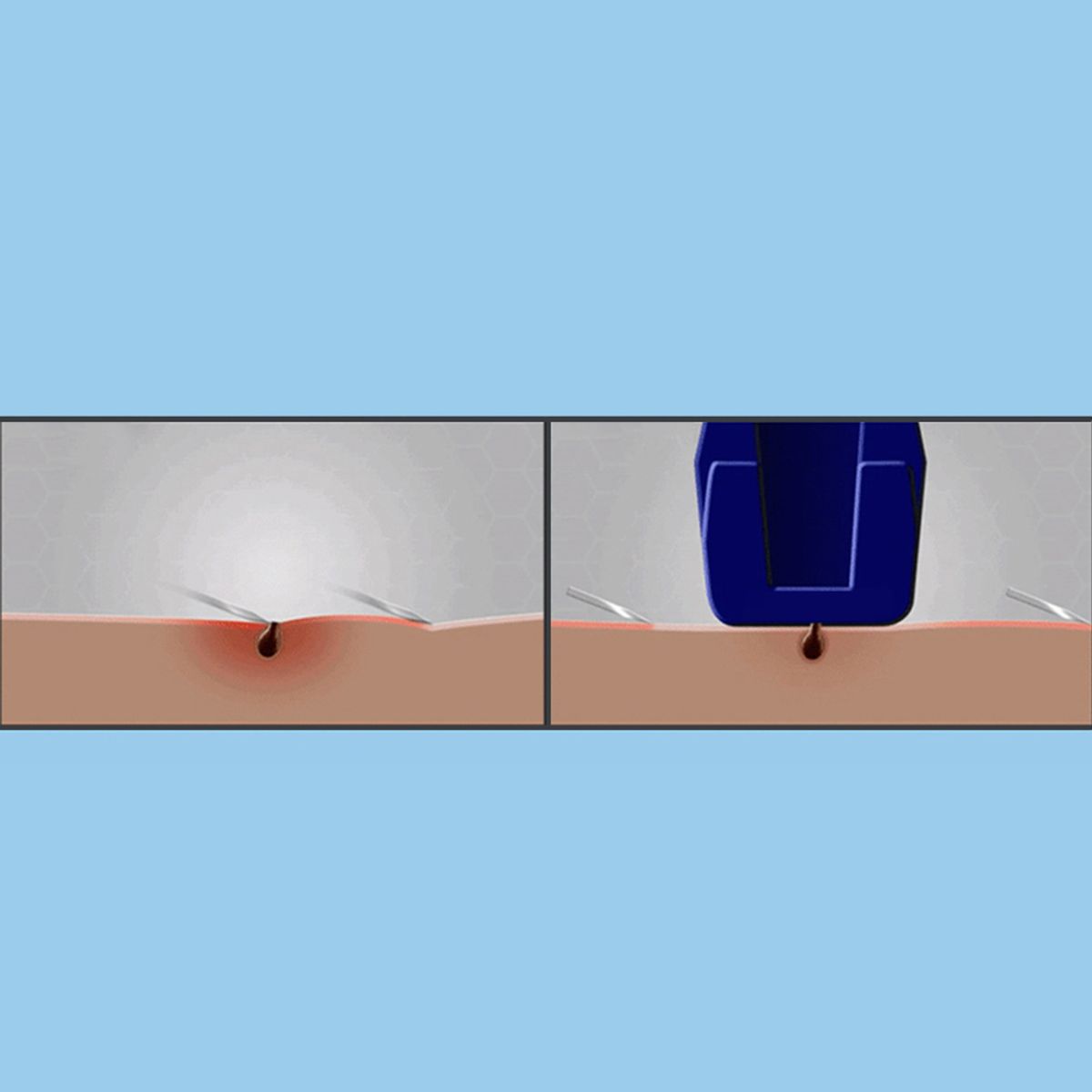 질레트(GILLETTE) 스킨텍 면도날 4입