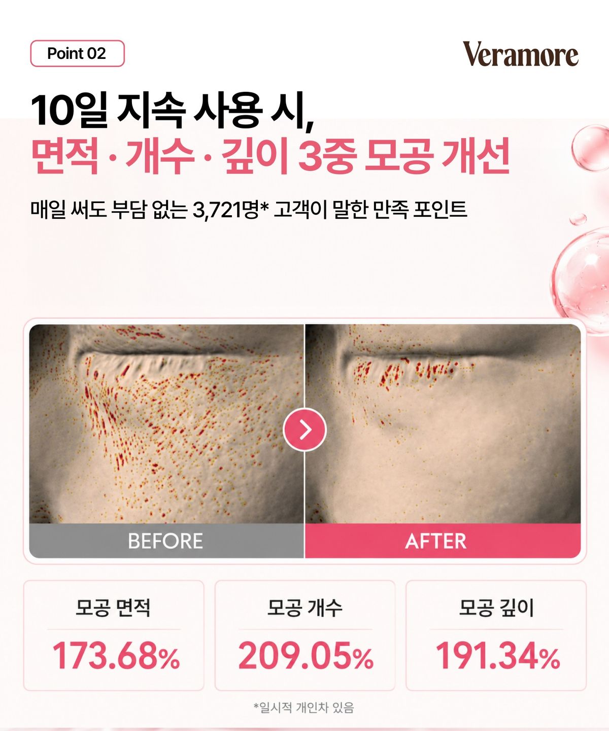 베라모어(VERAMORE) 포어 타이트닝 스피큘 300 앰플 50ml