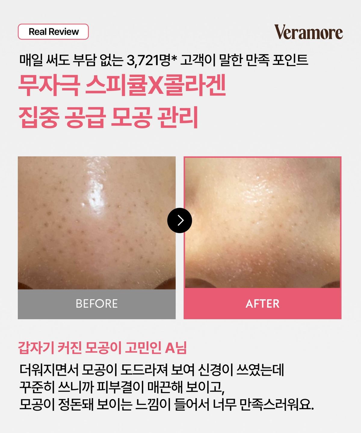 베라모어(VERAMORE) 포어 타이트닝 스피큘 300 앰플 50ml