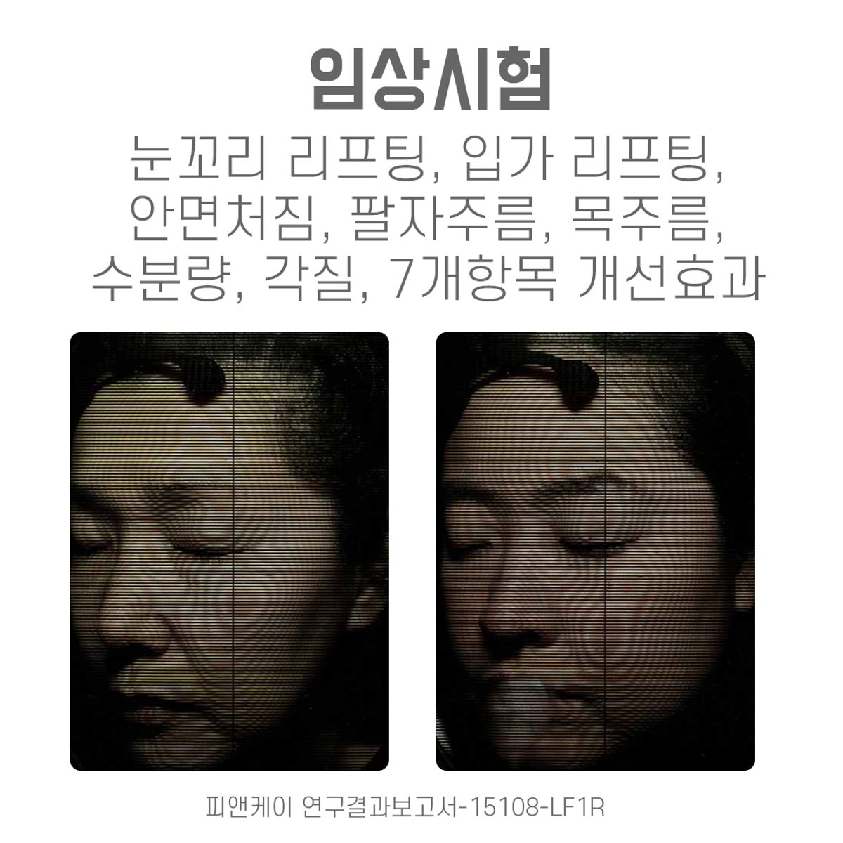 디에이구구(DA99) 녹는실 리프팅 앰플 1Pack(4병)