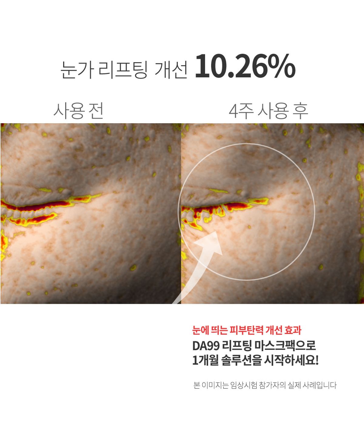 디에이구구(DA99) 더블업 리프팅 마스크팩 Pack(5매)