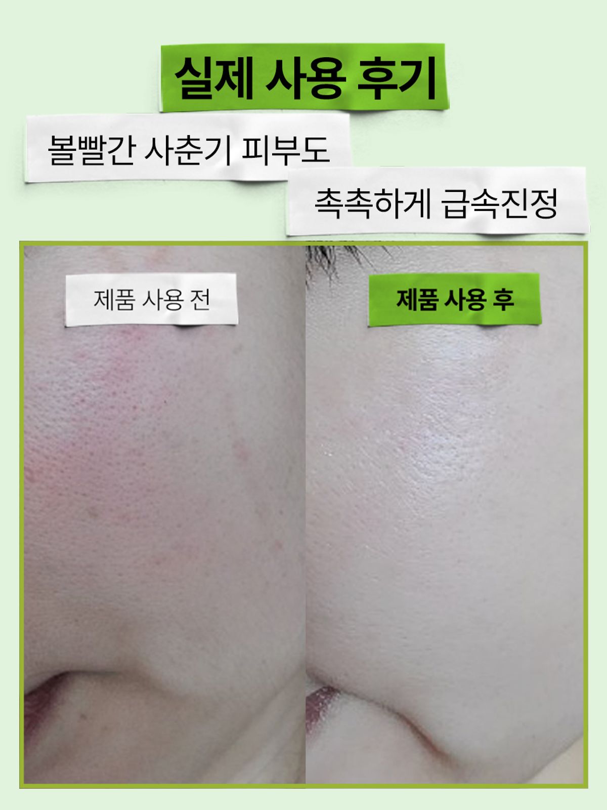 에필로우(EFILOW) [2 pack] 아티초크 히알루시카 촉촉진정 앰플 50ml