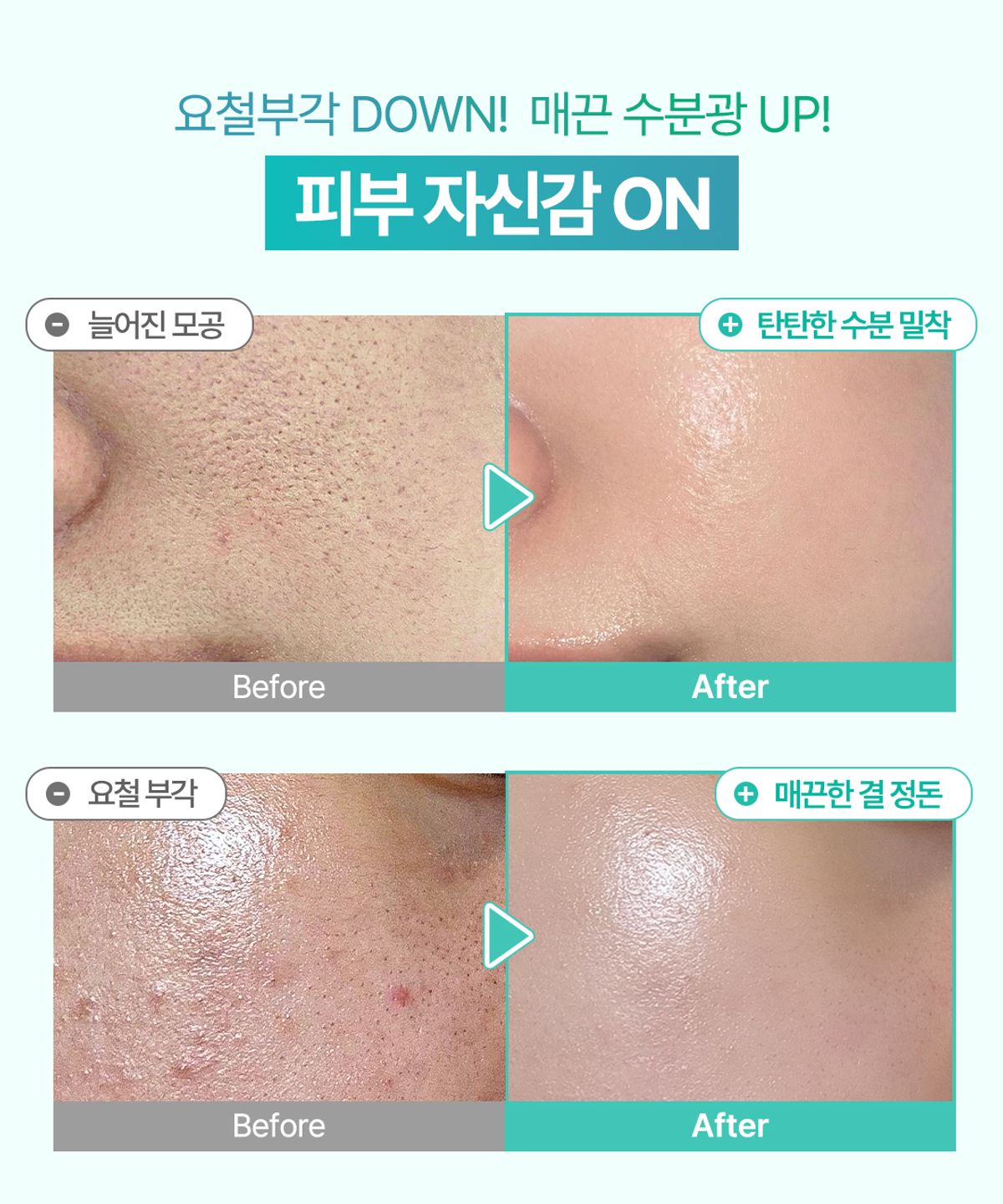 오미티드(OMITTED) 프레쉬라임 LHA 결광 모공 세럼 50ml