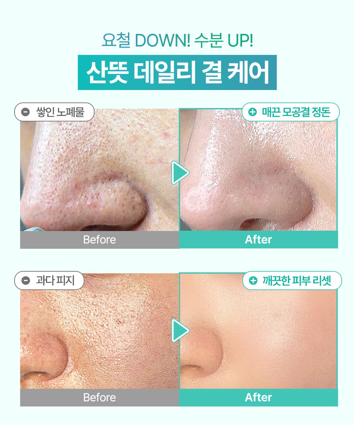 오미티드(OMITTED) 프레쉬라임 LHA 결광 모공 토너패드 70매