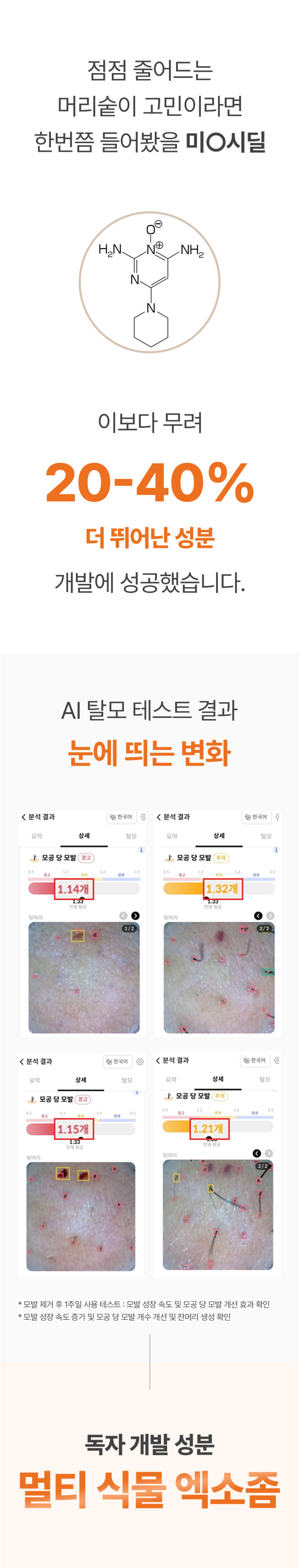 탈모 테스트 결과