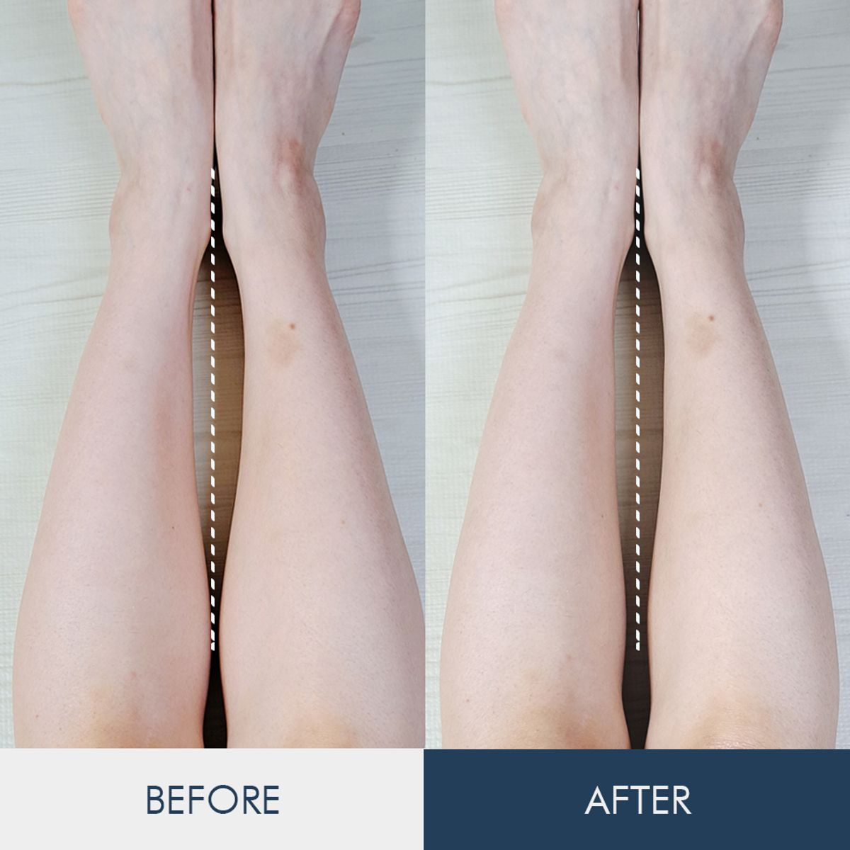 벨라쉐이프(VELASHAPE) 아나시스 근육통 바르는파스 악티브 웜업 크림150ml