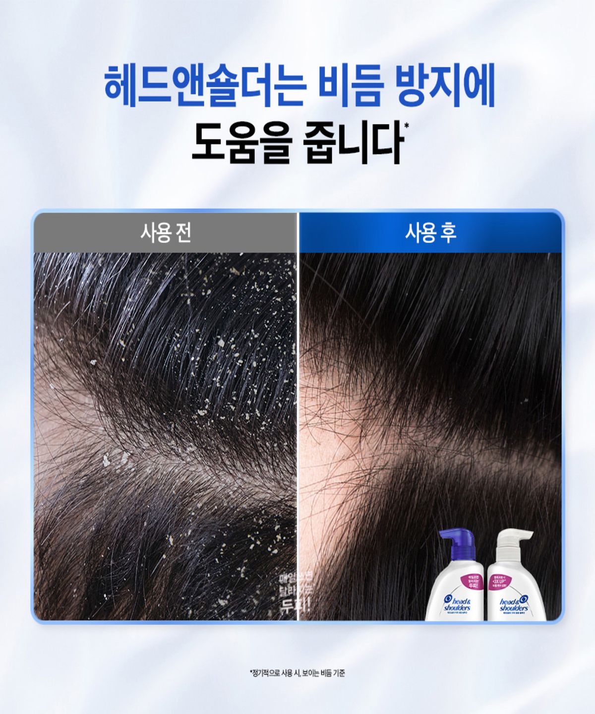 헤드앤숄더(HEAD&SHOULDER) 차콜 800ml 샴푸 2개