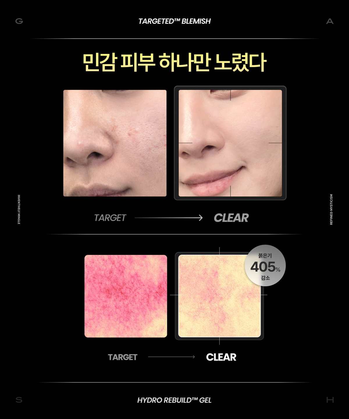 기어 바이 가쉬(GEAR BY GASH) [예민 피부 집중 관리] 타겟티드™ 블래미쉬 토너 _하이드로 리빌드겔™ 미스트 100ml