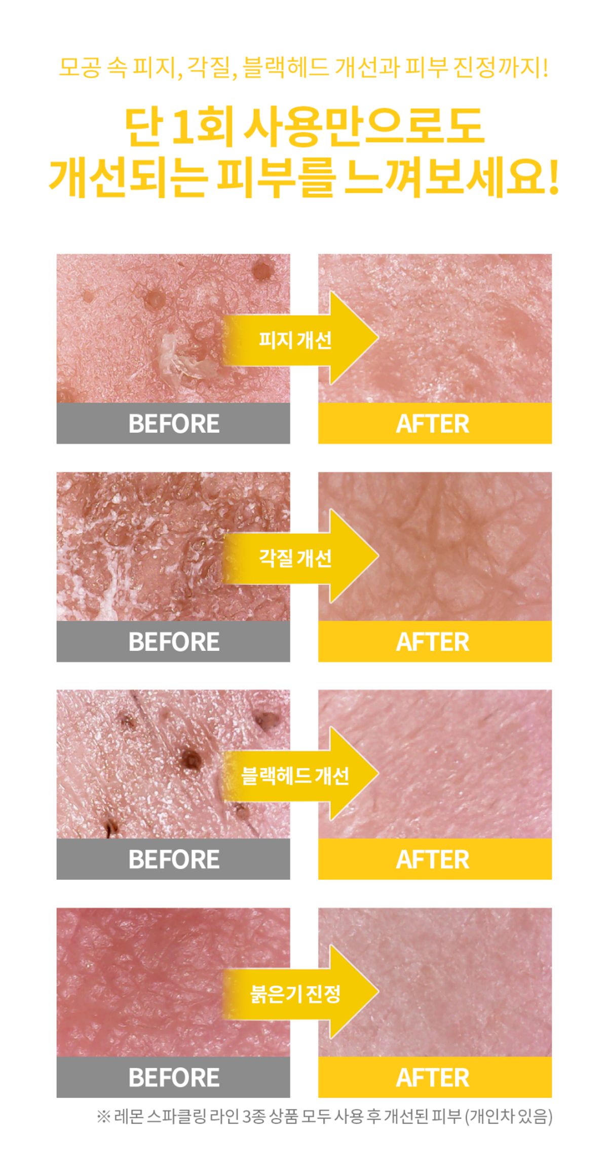 시크릿키 레몬 스파클링 클렌징폼 상세페이지 2