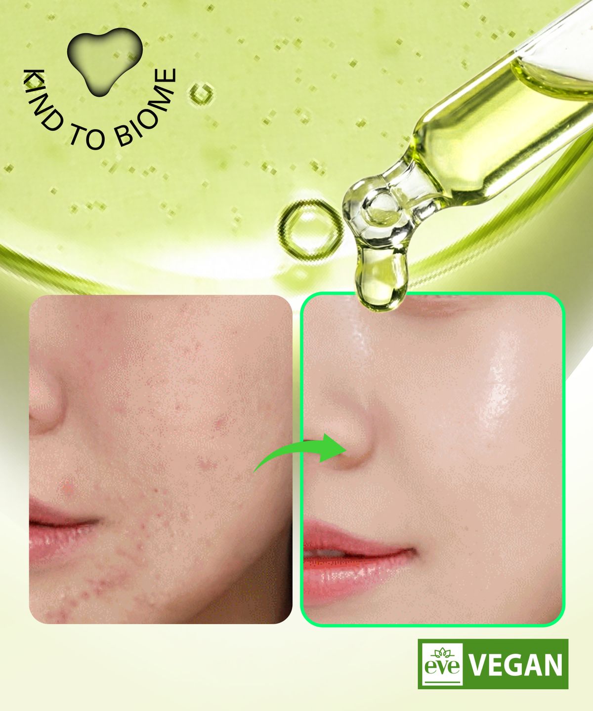 에필로우(EFILOW) 아티초크 바이옴 진정 앰플 50ml