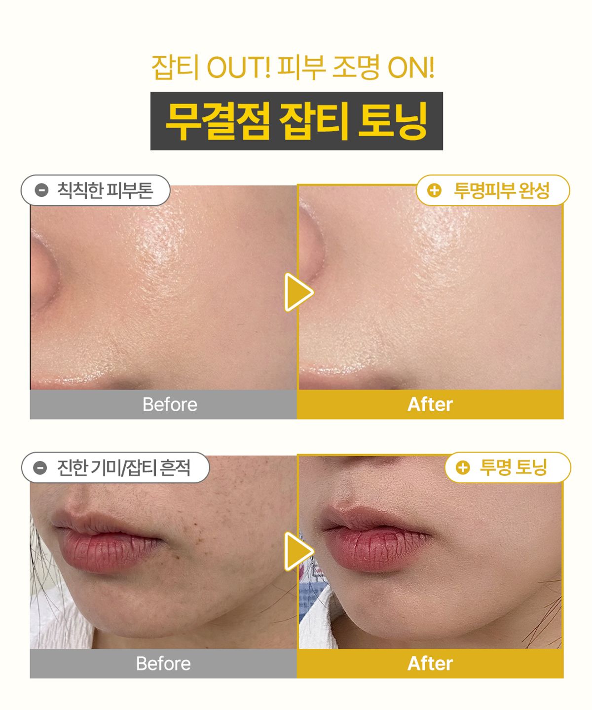 오미티드(OMITTED) 비타C 나이아신아마이드 5% 버블샷 앰플 90ml